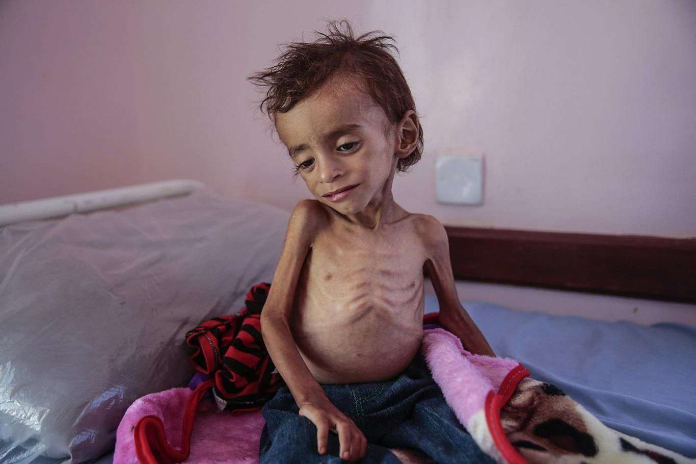 UNICEF: Yemen'de 7 milyon çocuk her gece yatağa aç giriyor UNICEF: Yemen'de 7 milyon çocuk her gece yatağa aç giriyor